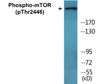 Phospho-mTOR (Thr2446) Colorimetric Cell-Based ELISA Kit