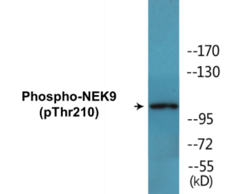 Phospho-NEK9 (Thr210) Colorimetric Cell-Based ELISA Kit