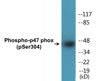 Phospho-p47 phox (Ser304) Colorimetric Cell-Based ELISA Kit