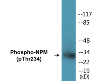 Phospho-NPM (Thr234) Colorimetric Cell-Based ELISA Kit