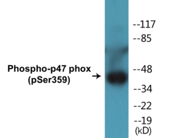 Phospho-p47 phox (Ser359) Colorimetric Cell-Based ELISA Kit