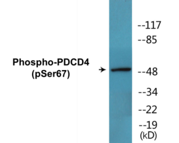 Phospho-PDCD4 (Ser67) Colorimetric Cell-Based ELISA Kit