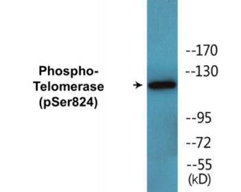 Phospho-Telomerase (Ser824) Colorimetric Cell-Based ELISA Kit