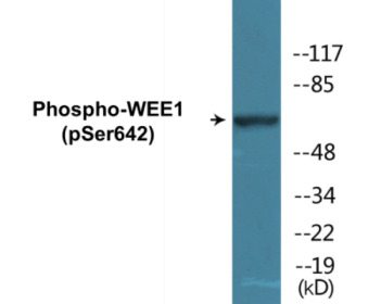 Phospho-WEE1 (Ser642) Colorimetric Cell-Based ELISA Kit