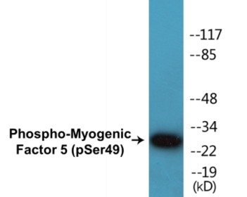 Phospho-Myogenic Factor 5 (Ser49) Colorimetric Cell-Based ELISA Kit
