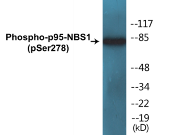 Phospho-p95-NBS1 (Ser278) Colorimetric Cell-Based ELISA Kit