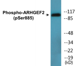 Phospho-ARHGEF2 (Ser885) Colorimetric Cell-Based ELISA Kit
