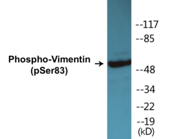 Phospho-Vimentin (Ser83) Colorimetric Cell-Based ELISA Kit