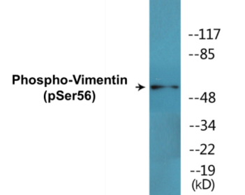 Phospho-Vimentin (Ser56) Colorimetric Cell-Based ELISA Kit