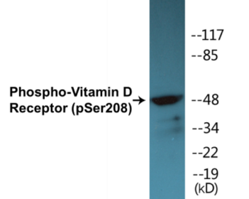 Phospho-Vitamin D Receptor (Ser208) Colorimetric Cell-Based ELISA Kit