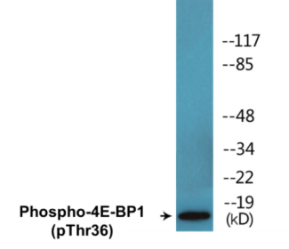 Phospho-4E-BP1 (Thr36) Colorimetric Cell-Based ELISA Kit