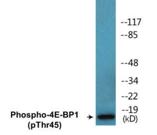 Phospho-4E-BP1 (Thr45) Colorimetric Cell-Based ELISA Kit