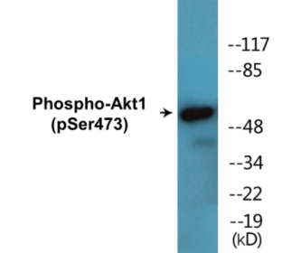 Phospho-Akt1 (Ser473) Colorimetric Cell-Based ELISA Kit