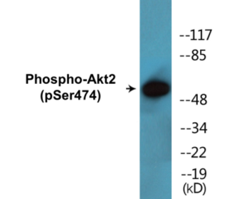 Phospho-Akt2 (Ser474) Colorimetric Cell-Based ELISA Kit