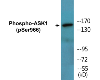 Phospho-ASK1 (Ser966) Colorimetric Cell-Based ELISA Kit