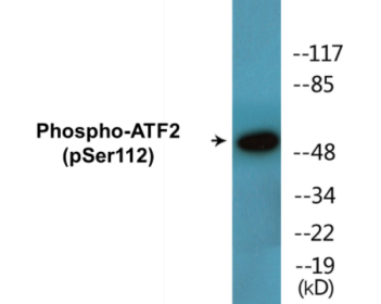 Phospho-ATF2 (Ser112) Colorimetric Cell-Based ELISA Kit