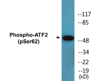 Phospho-ATF2 (Ser62) Colorimetric Cell-Based ELISA Kit