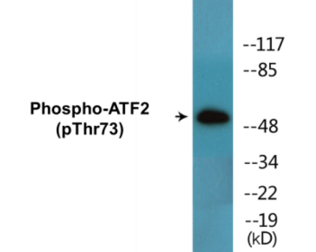 Phospho-ATF2 (Thr73) Colorimetric Cell-Based ELISA Kit