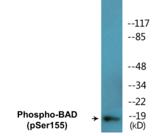 Phospho-BAD (Ser155) Colorimetric Cell-Based ELISA Kit