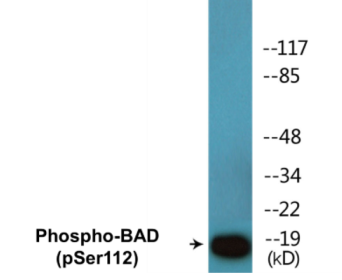 Phospho-BAD (Ser112) Colorimetric Cell-Based ELISA Kit