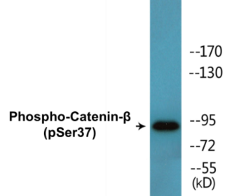 Phospho-Catenin-beta (Ser37) Colorimetric Cell-Based ELISA Kit