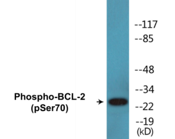 Phospho-BCL-2 (Ser70) Colorimetric Cell-Based ELISA Kit