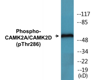 Phospho-CAMK2A/CAMK2D (Thr286) Colorimetric Cell-Based ELISA Kit