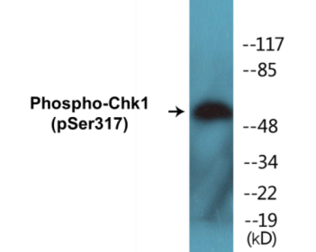 Phospho-Chk1 (Ser317) Colorimetric Cell-Based ELISA Kit