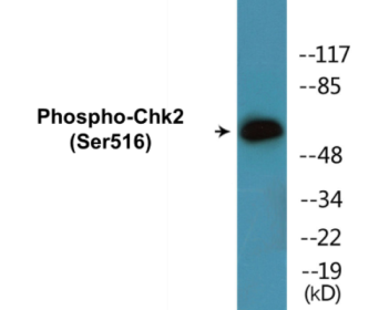 Phospho-Chk2 (Ser516) Colorimetric Cell-Based ELISA Kit
