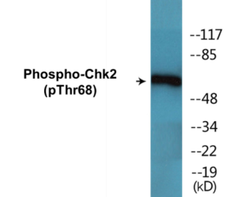 Phospho-Chk2 (Thr68) Colorimetric Cell-Based ELISA Kit