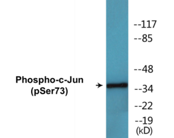 Phospho-c-Jun (Ser73) Colorimetric Cell-Based ELISA Kit