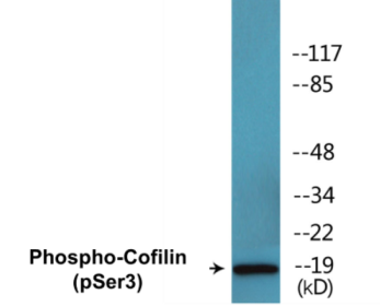Phospho-Cofilin (Ser3) Colorimetric Cell-Based ELISA Kit
