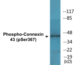 Phospho-Connexin 43 (Ser367) Colorimetric Cell-Based ELISA Kit