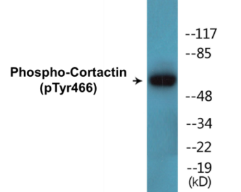 Phospho-Cortactin (Tyr466) Colorimetric Cell-Based ELISA Kit