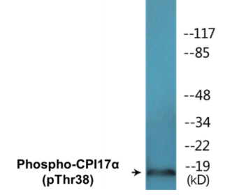 Phospho-CPI17alpha (Thr38) Colorimetric Cell-Based ELISA Kit