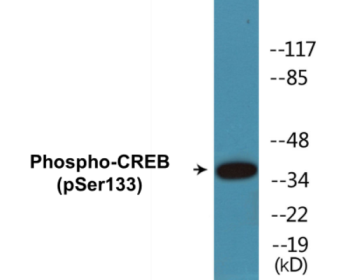 Phospho-CREB (Ser133) Colorimetric Cell-Based ELISA Kit
