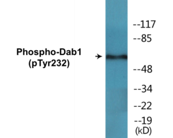 Phospho-Dab1 (Tyr232) Colorimetric Cell-Based ELISA Kit