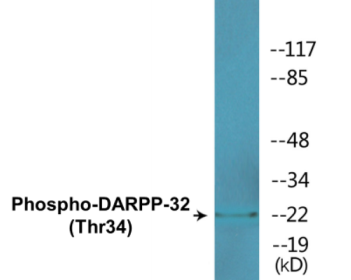 Phospho-DARPP-32 (Thr34) Colorimetric Cell-Based ELISA Kit
