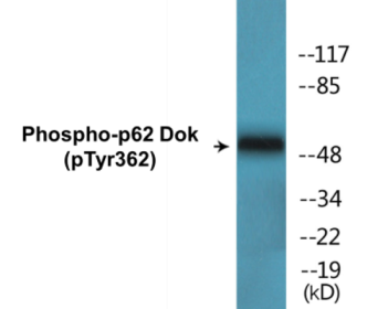Phospho-p62 Dok (Tyr362) Colorimetric Cell-Based ELISA Kit