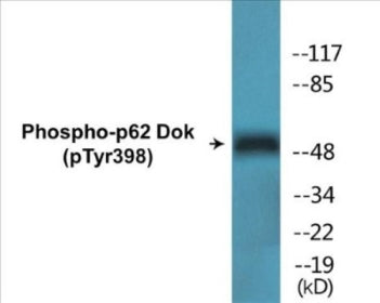 Phospho-p62 Dok (Tyr398) Colorimetric Cell-Based ELISA Kit