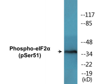 Phospho-eIF2alpha (Ser51) Colorimetric Cell-Based ELISA Kit