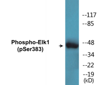 Phospho-Elk1 (Ser383) Colorimetric Cell-Based ELISA Kit