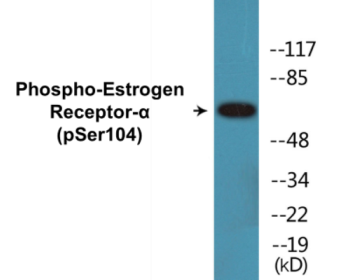 Phospho-Estrogen Receptor-alpha (Ser104) Colorimetric Cell-Based ELISA Kit