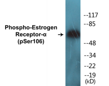 Phospho-Estrogen Receptor-alpha (Ser106) Colorimetric Cell-Based ELISA Kit