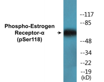 Phospho-Estrogen Receptor-alpha (Ser118) Colorimetric Cell-Based ELISA Kit