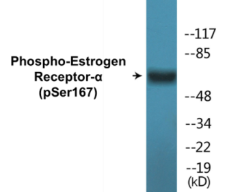 Phospho-Estrogen Receptor-alpha (Ser167) Colorimetric Cell-Based ELISA Kit