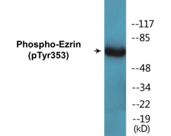 Phospho-Ezrin (Tyr353) Colorimetric Cell-Based ELISA Kit