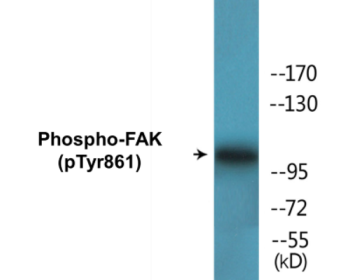 Phospho-FAK (Tyr861) Colorimetric Cell-Based ELISA Kit