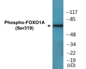 Phospho-FOXO1A (Ser319) Colorimetric Cell-Based ELISA Kit