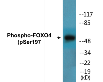 Phospho-FOXO4 (Ser197) Colorimetric Cell-Based ELISA Kit